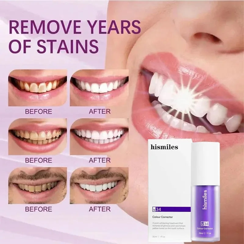 Teeth Brightening Hismiles V34 Colour Corrector Serum (30ml)