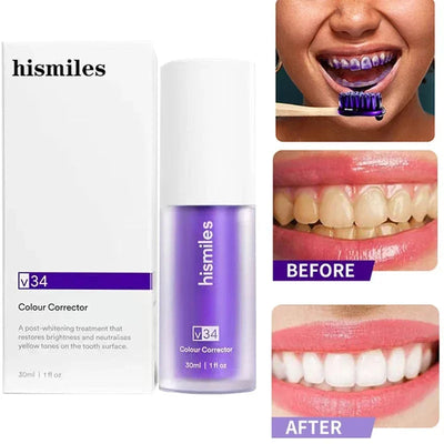 Teeth Brightening Hismiles V34 Colour Corrector Serum (30ml)
